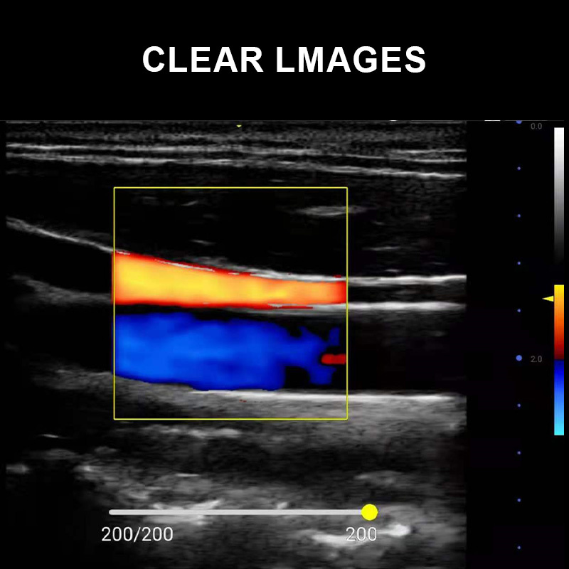 ECI-E7 Portable Veterinary Ultrasound Scanner-detail 5