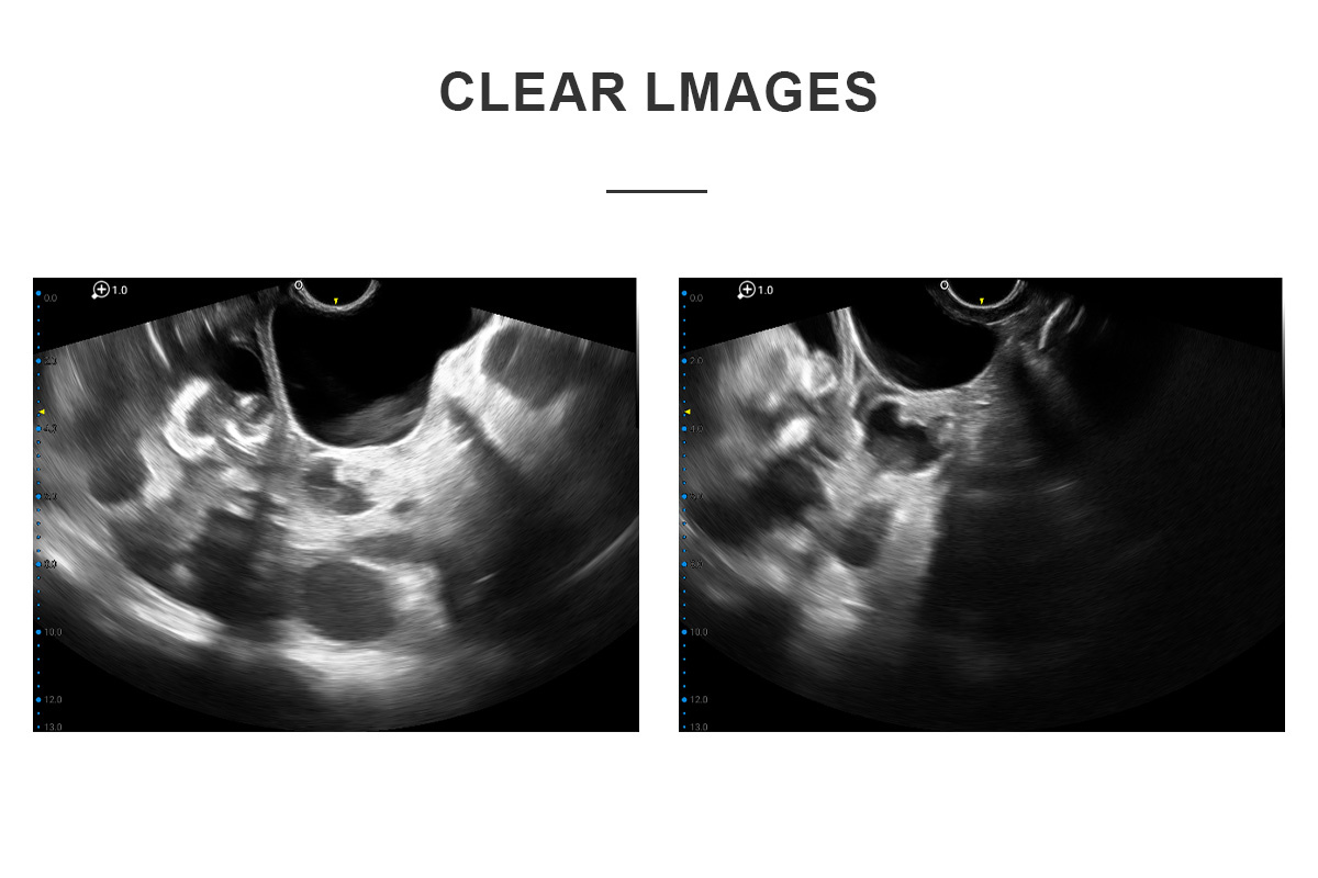 ECI-E7 Portable Veterinary Ultrasound Scanner-detail 6