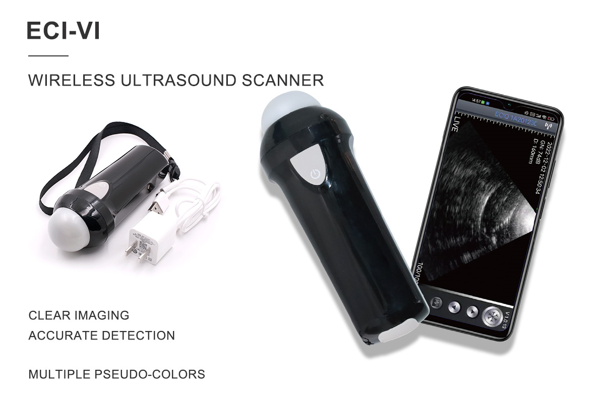 ECI-V1 Wireless Ultrasound Scanner-detail 1