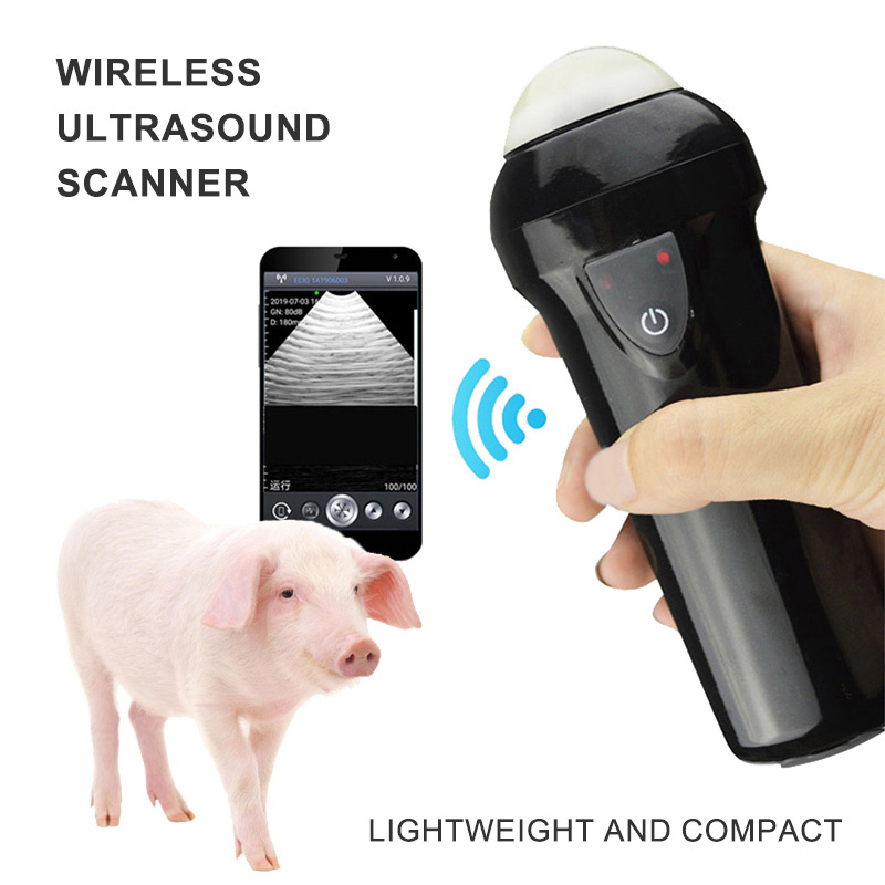 ECI-V1 Wireless Ultrasound Scanner-detail 4