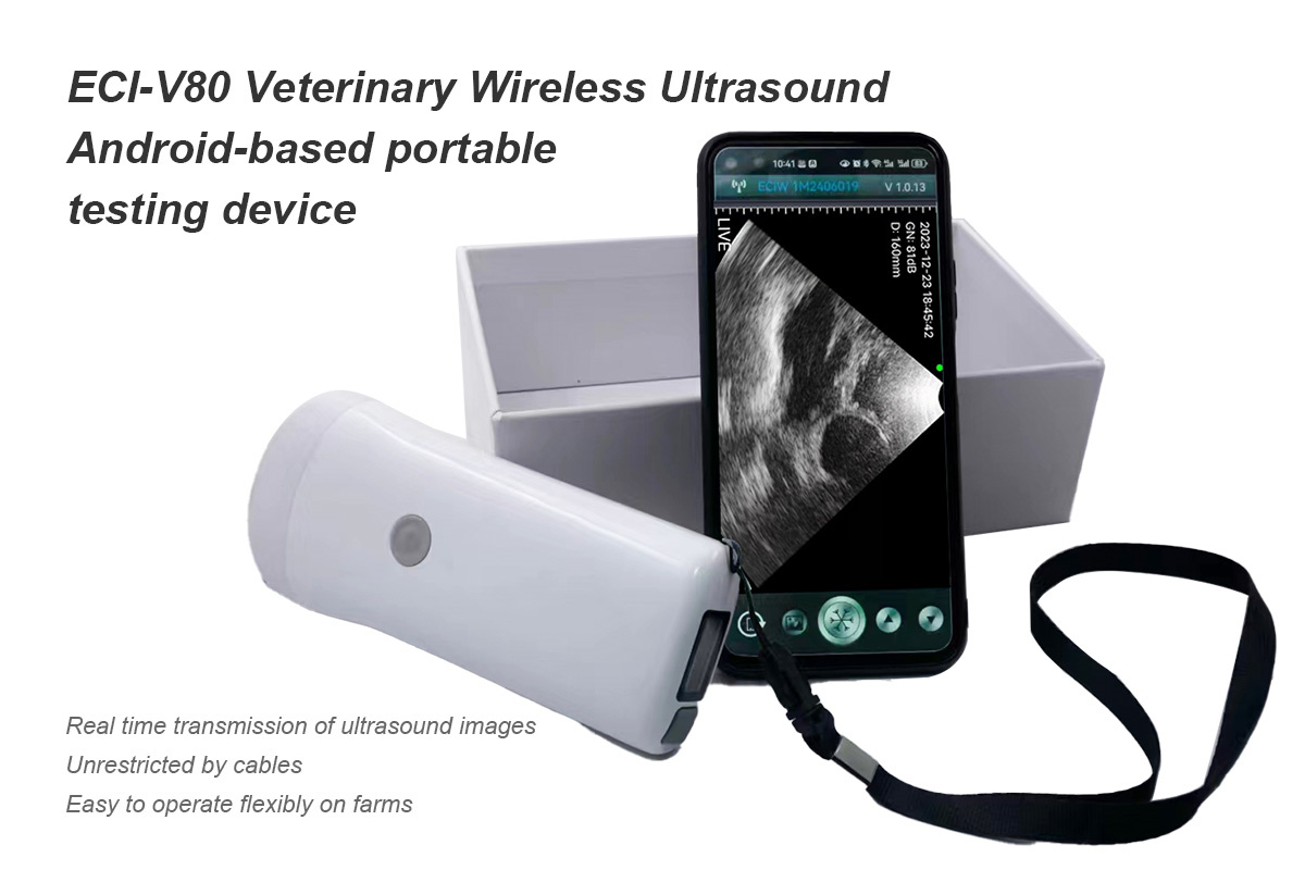 ECI-V80 Wireless Ultrasound Scanner-detail 1