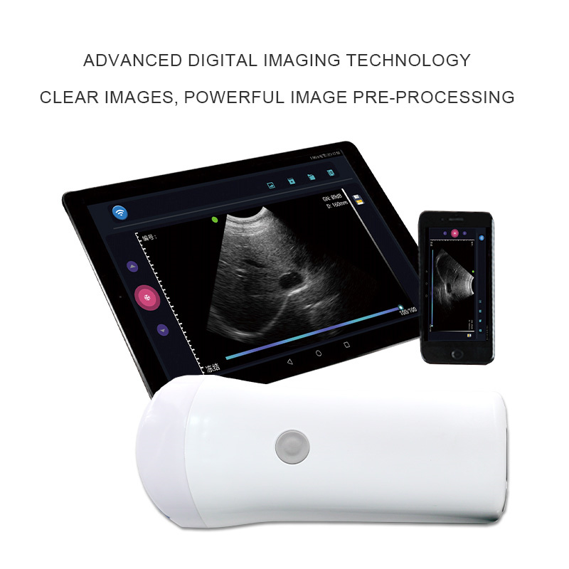 ECI-V80 Wireless Ultrasound Scanner-detail 2