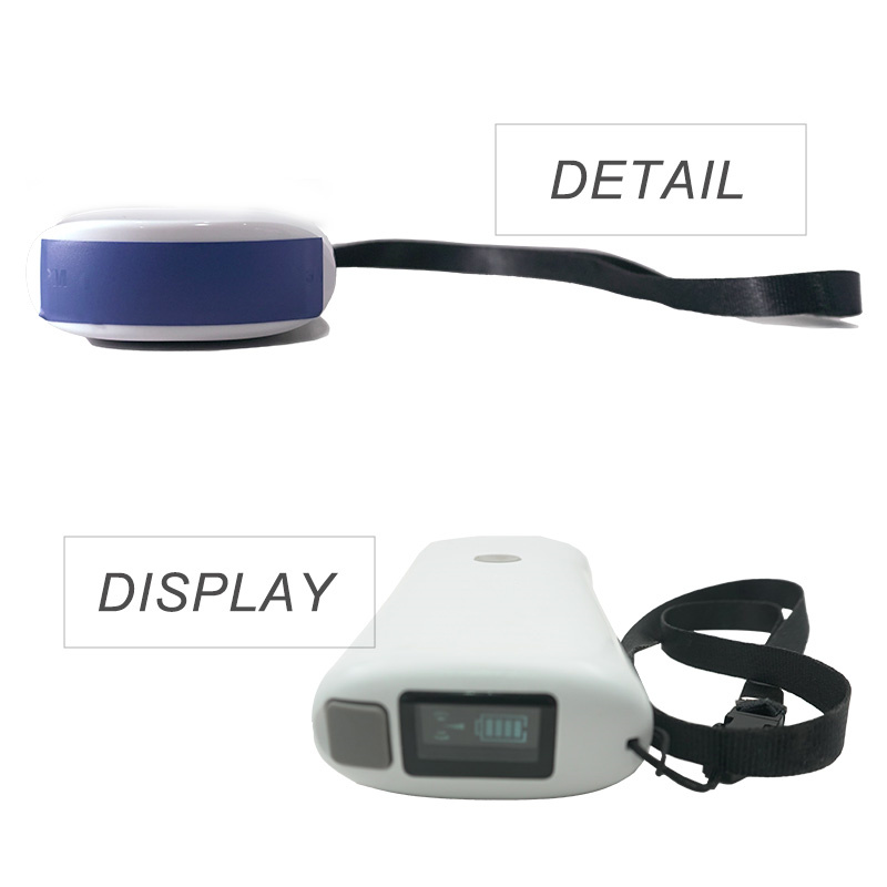 ECI-V80 Wireless Ultrasound Scanner-detail 3