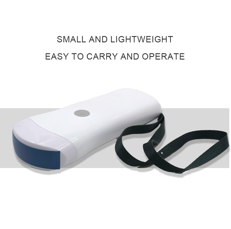 ECI-V80 Wireless Ultrasound Scanner-detail 4