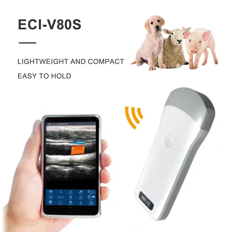 ECI-V80S Wireless Ultrasound Scanner-detail 1