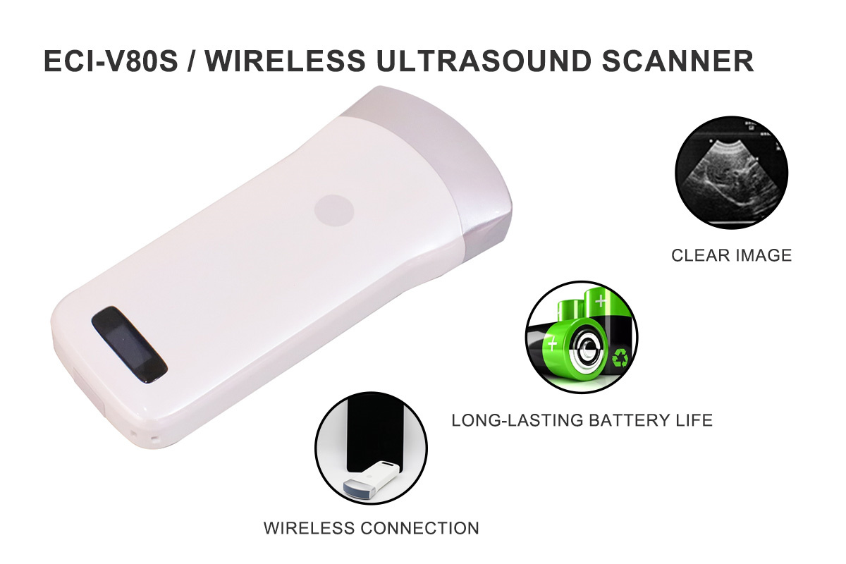 ECI-V80S Wireless Ultrasound Scanner-detail 2
