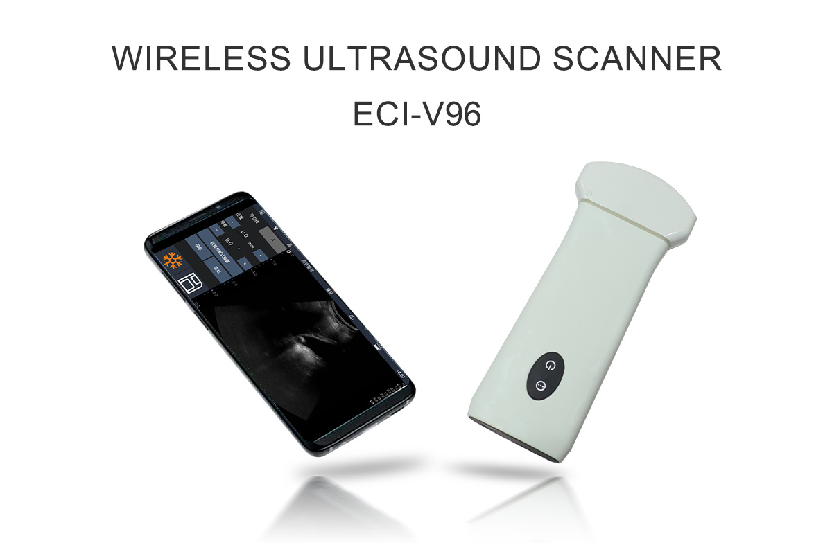 ECI-V96 Wireless Ultrasound Scanner-detail 1