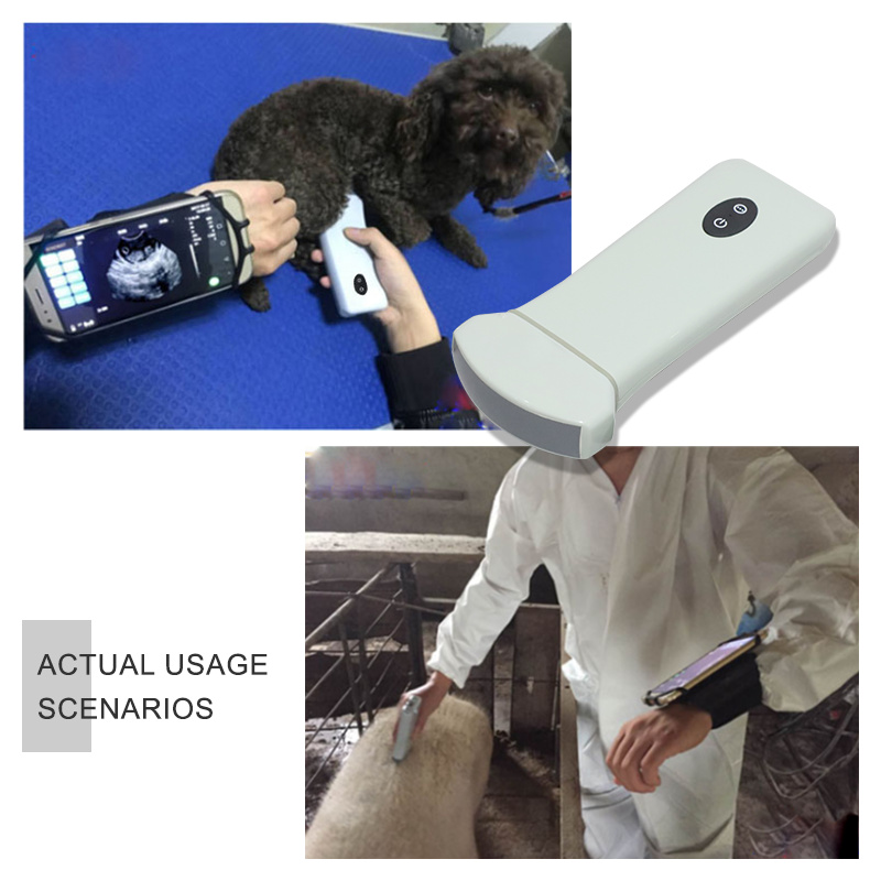 ECI-V96 Wireless Ultrasound Scanner-detail 5