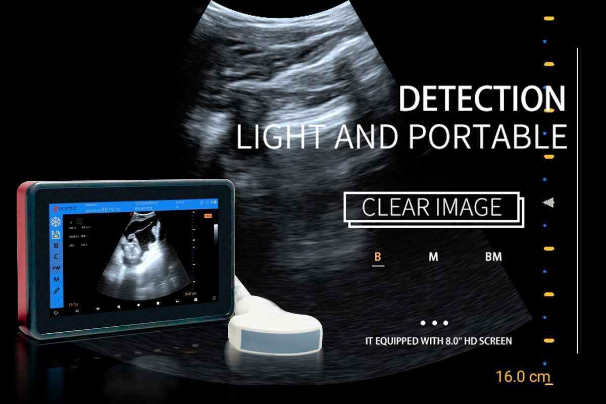 ECI-X5 Veterinary Color Doppler Ultrasound Scanner-detail 3