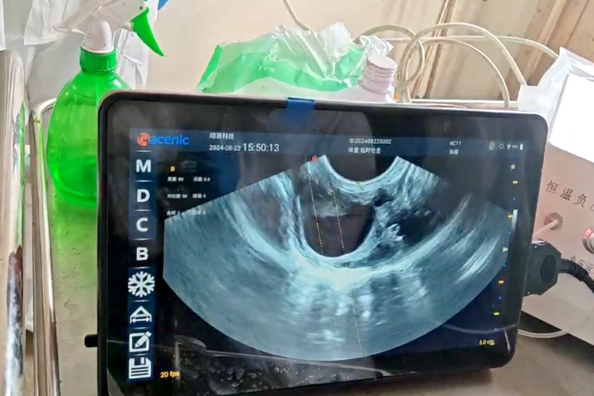 ECI-X7H Portable Veterinary Ultrasound Scanner-detail 4 application
