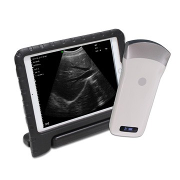 CW-3C Waterproof Wireless Convex Ultrasound Probe Scanner