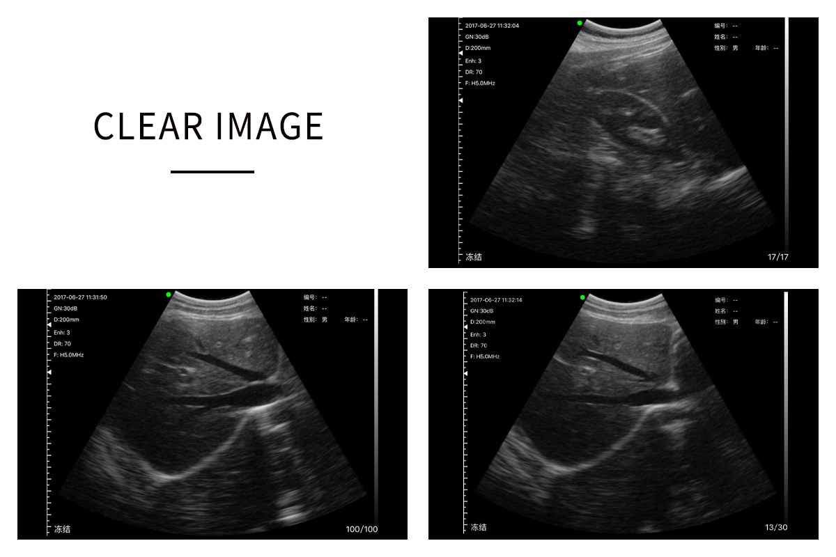 CW-3C convex palm B_W ultrasound-detail 3