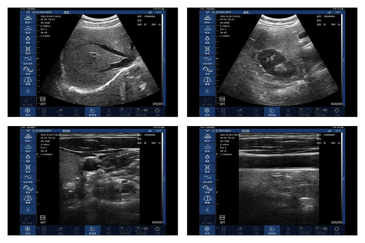 CW-3CL palm doppler ultrasound-detail 2