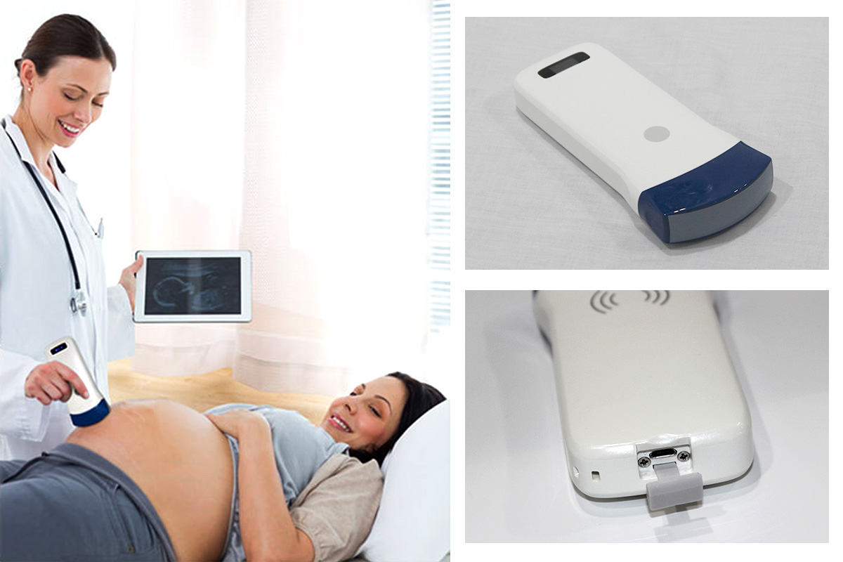 CW-5C convex palm doppler ultrasound-detail 1