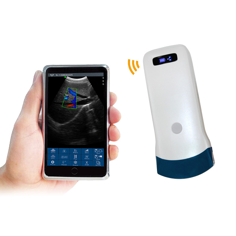 CW-5C convex palm doppler ultrasound-detail 2