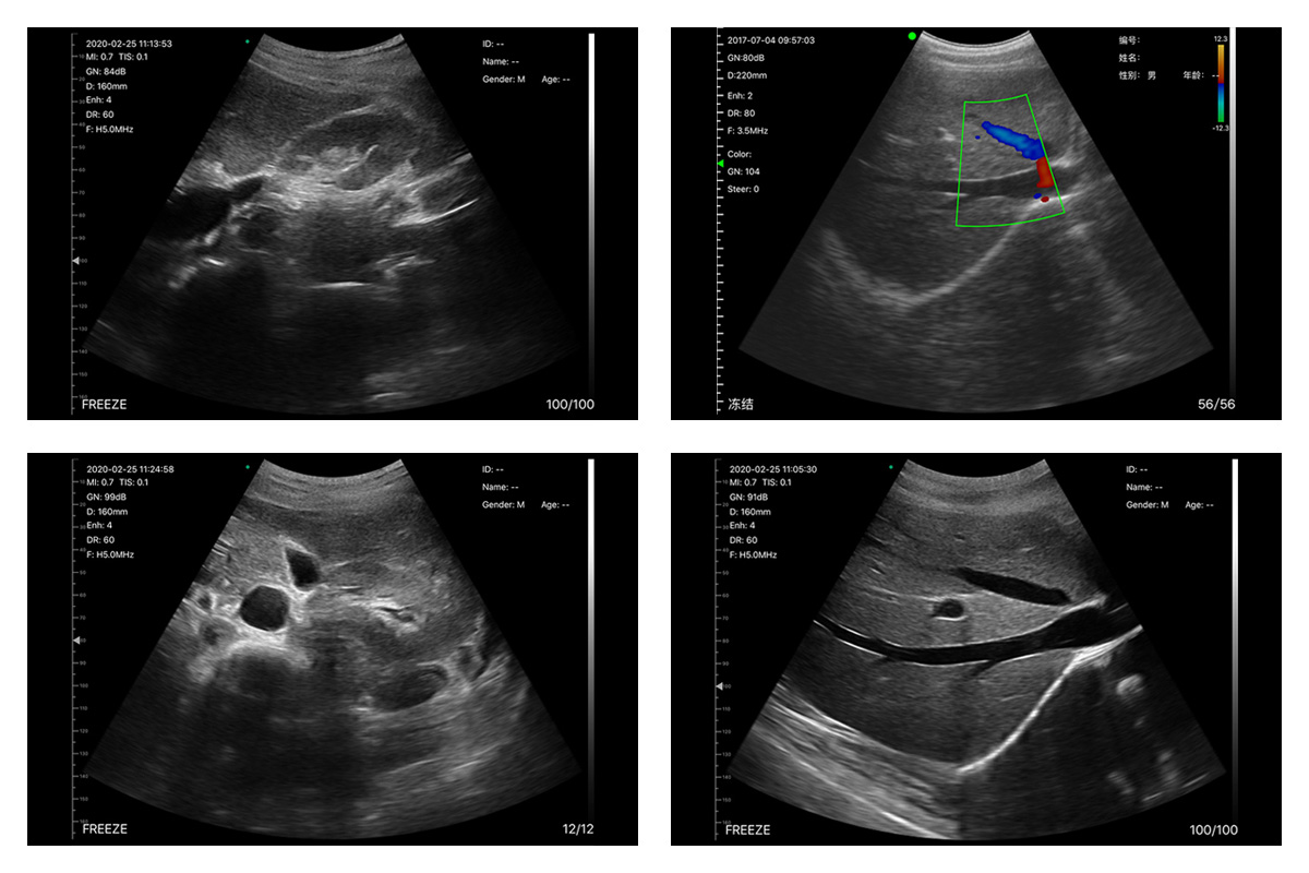 CW-5C convex palm doppler ultrasound-detail 5
