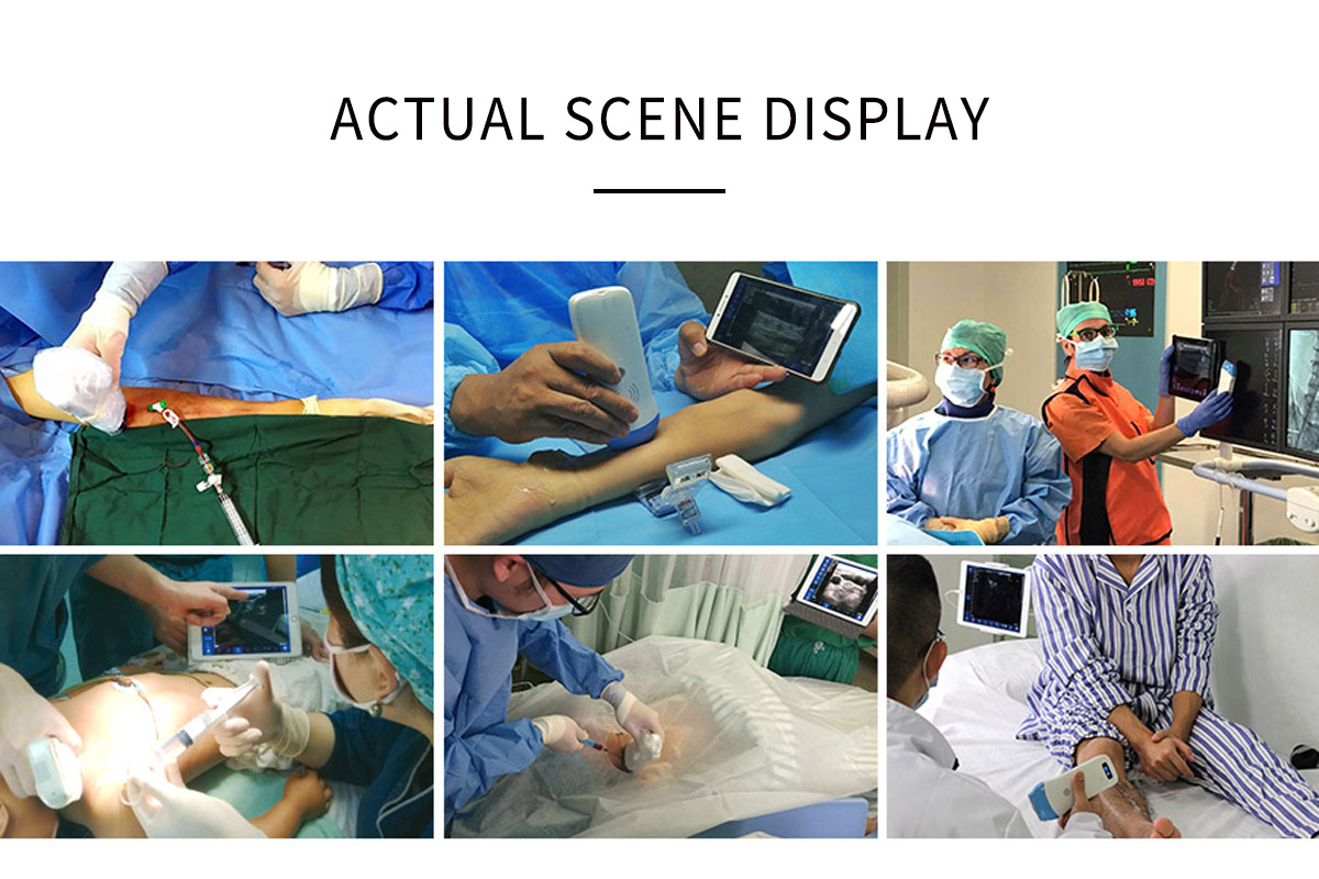 CW-5L linear palm doppler ultrasound-detail 3