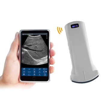 CW-6C Convex Wireless Handheld Ultrasound Probe