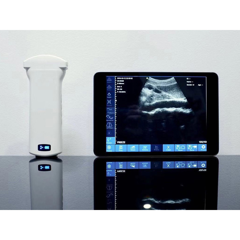 CW-6C convex palm doppler ultrasound-detail 1