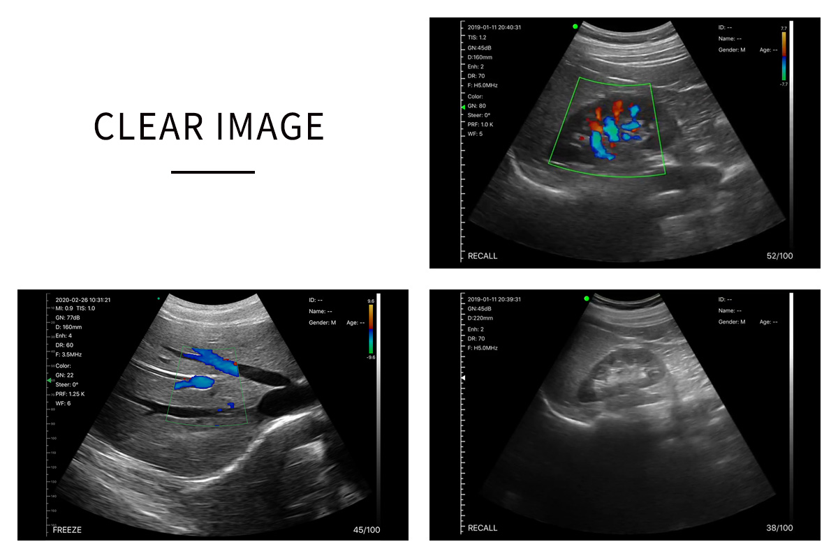 CW-6C convex palm doppler ultrasound-detail 3