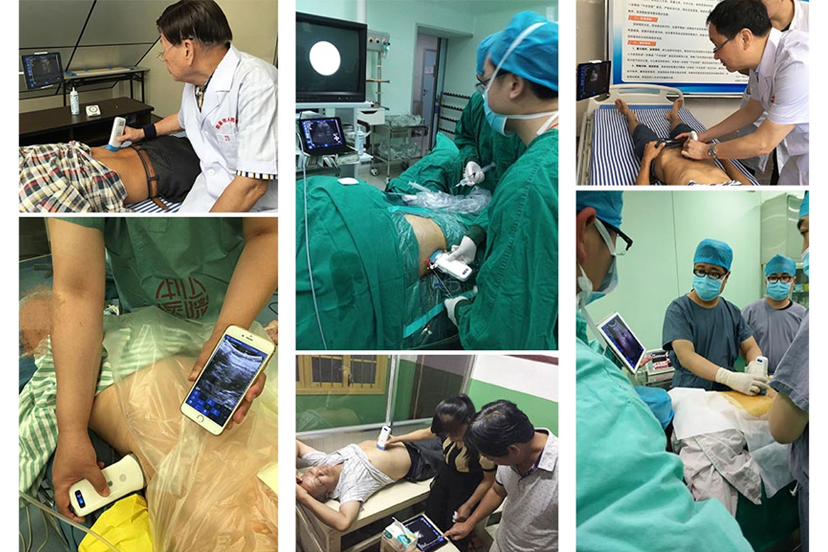 CW-6C convex palm doppler ultrasound-detail 4
