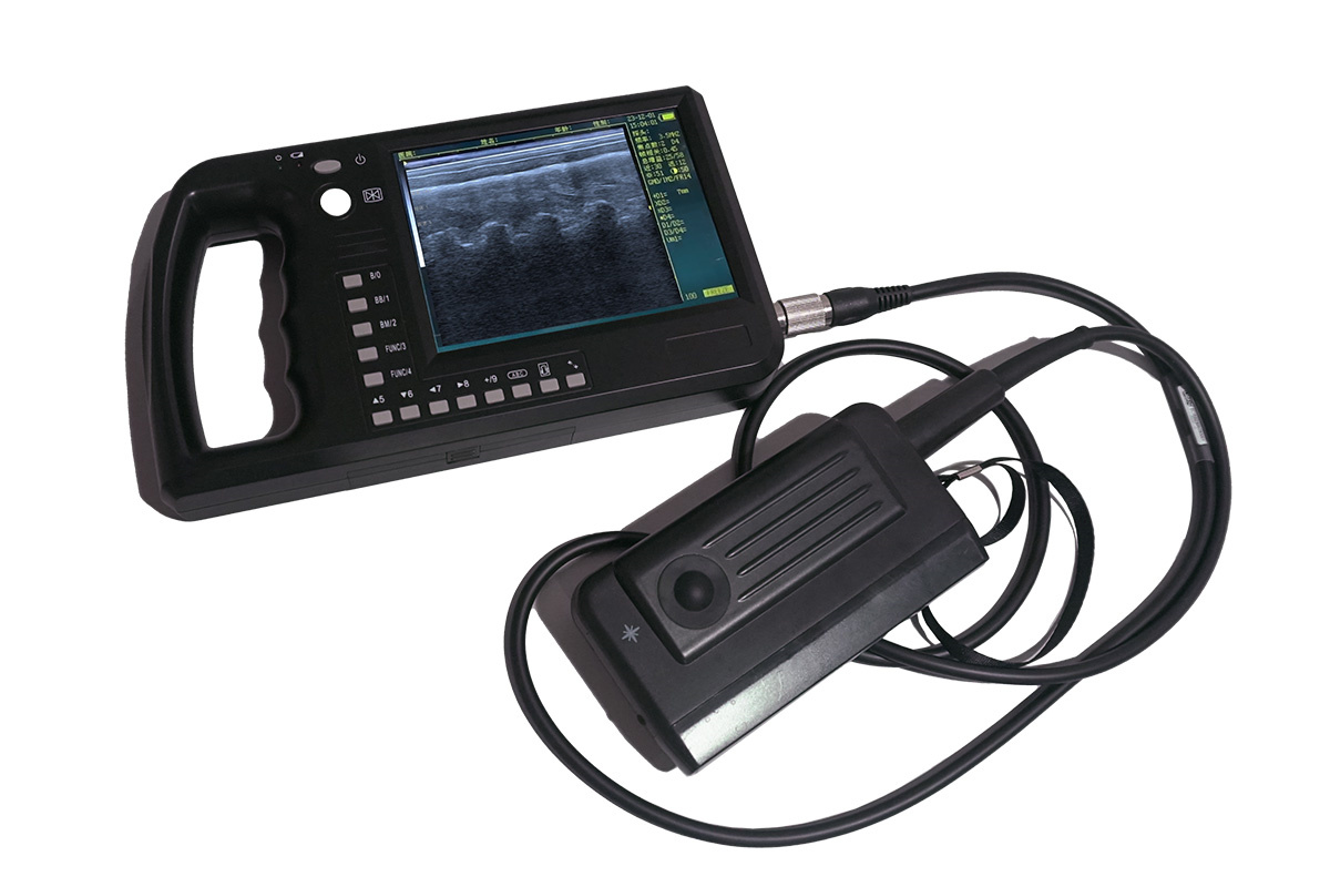 ECI-3000A Eye Muscle Area Ultrasound Measuring Instrument-detail 1