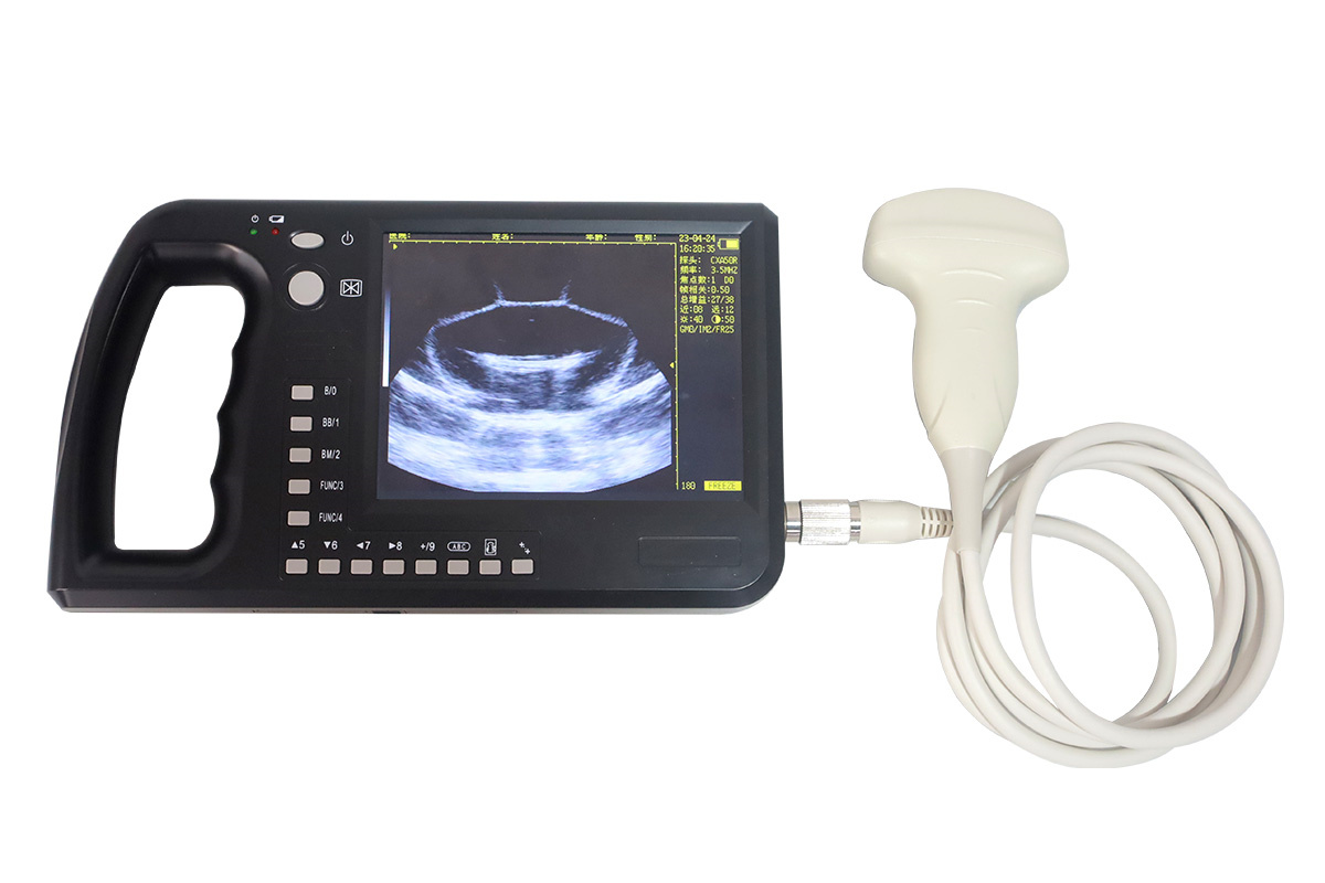 ECI-3000A Eye Muscle Area Ultrasound Measuring Instrument-detail 2
