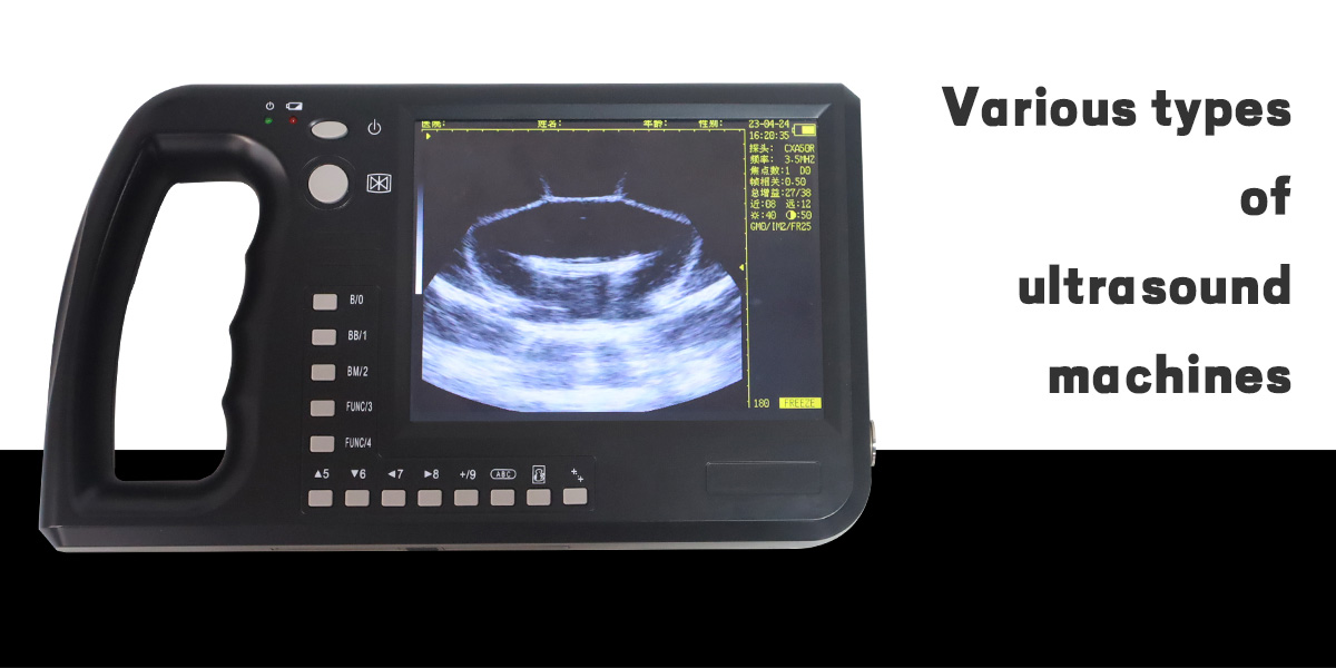 Pila ka Klase sa mga Makina sa Ultrasound ang Anaa?