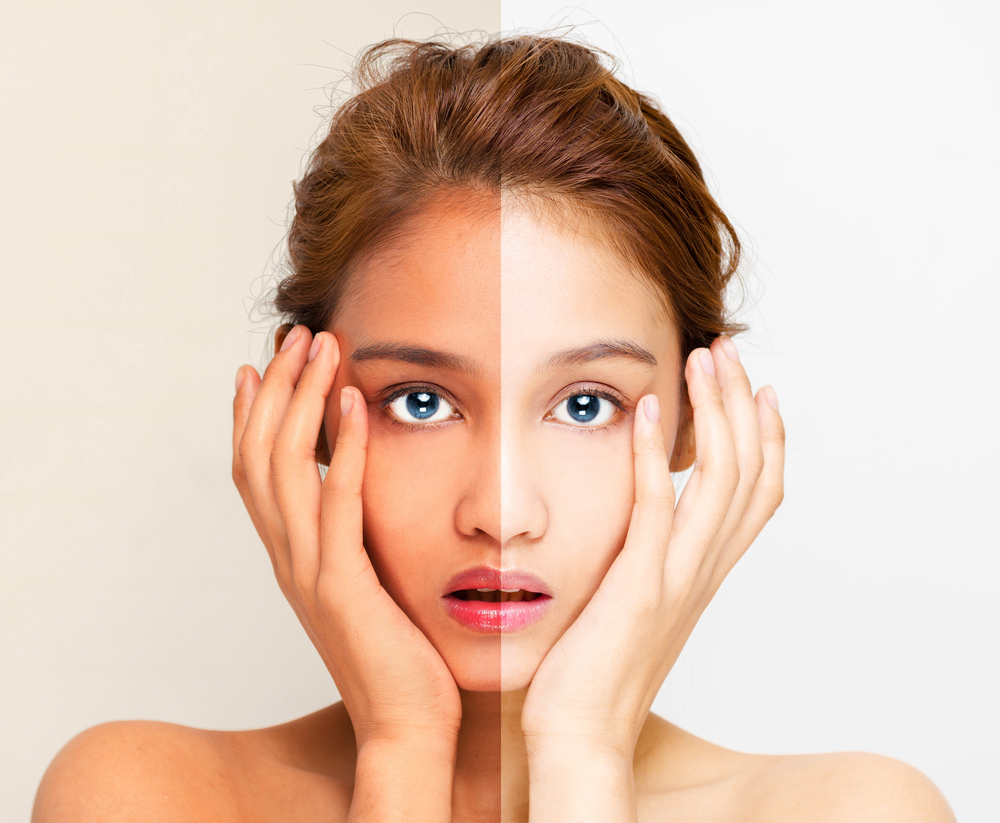 Revolutionary Whitening Matrix:N-Acetyl-D-Glucosamine + Synergistic Actives for Ultimate Skin Brightening