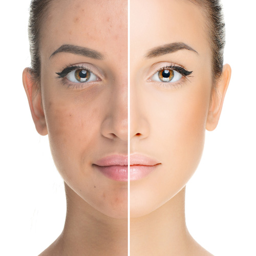 N - Acetyl Glucosamine (NAG): A Versatile Player in the Cosmetics Field​