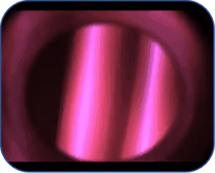 Công nghệ khắc (2)