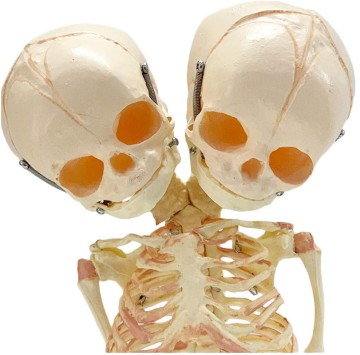 Fetus Skeleton Model with Two Skulls Detachable Baby Medical Science