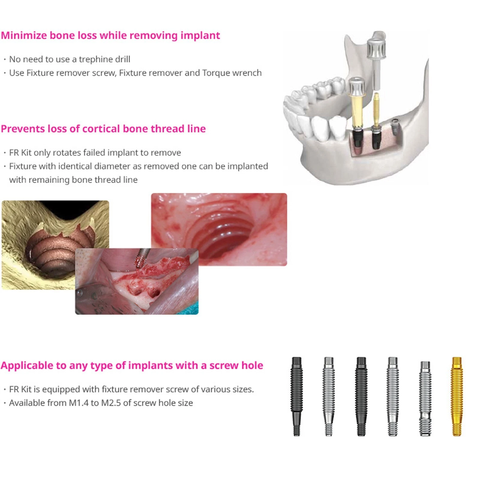Kit d'extraction d'implants dentaires (5).png