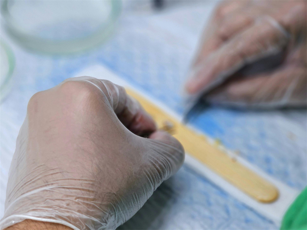 Disposable Vinyl Glove For Medical Examination (6)