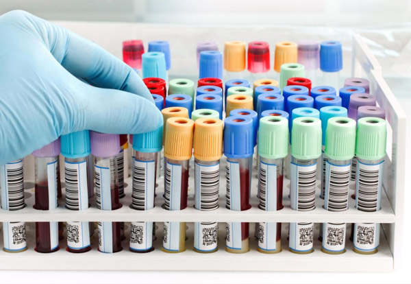 The Cost of Vacuum Blood Collection Tubes for Hospitals Every Year