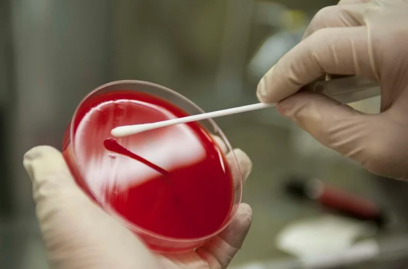 Researchers develop handheld device for rapid bacterial detection