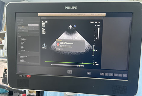 Philips Ultrasonic Technology Case