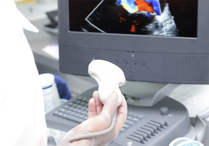 More than 100,000 ultrasound service casesdlt