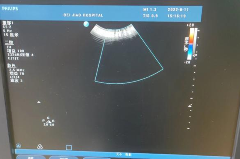 Philips CX50 Measurement Function Not Workszdw