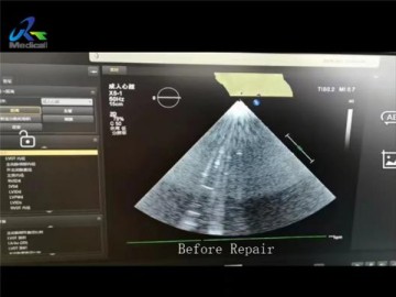 Philips Epiq X5-1 Ultrasound Probe Repair