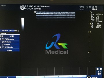 GE 7L-RC 12MHz Wide Band Linearx Used Ultrasound Probe Medical Hospital Instrument