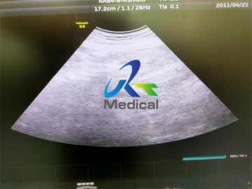 GE RAB4-8-RS 4D Ultrasound Transducer Repair Cardiovascular Ultrasound Machine