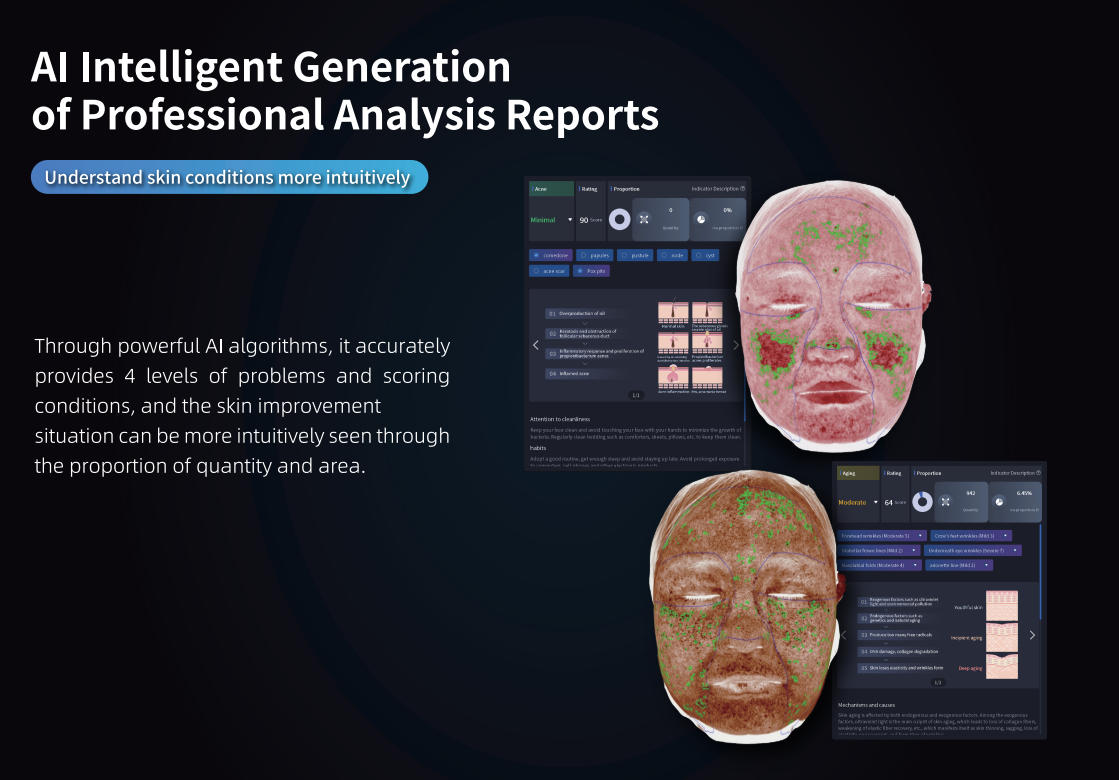 AI-Powered Smart Report Generation (Scores & Percentages)