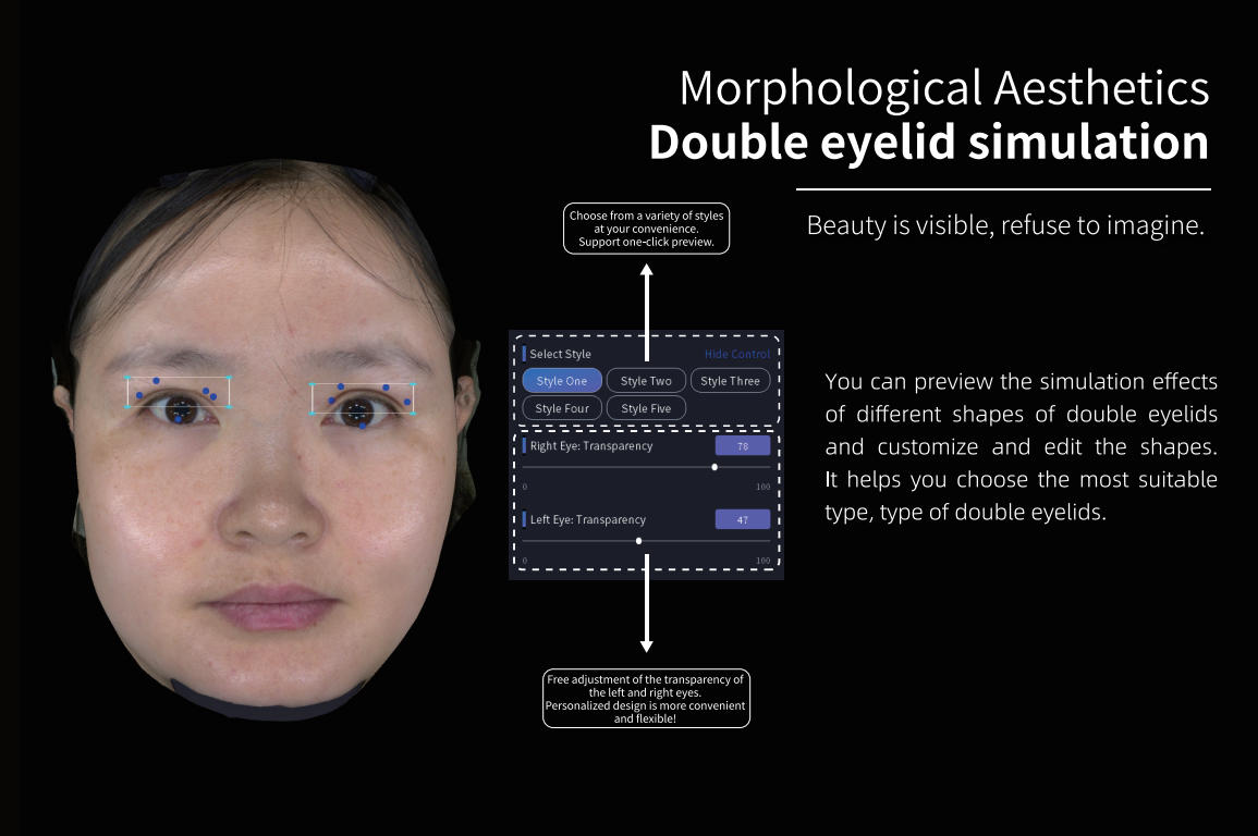 Double Eyelid  Injection  Volume Simulation