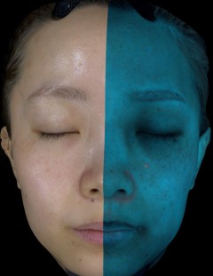 UV light image