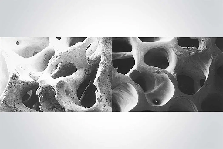 Bone meal (3)j7x
