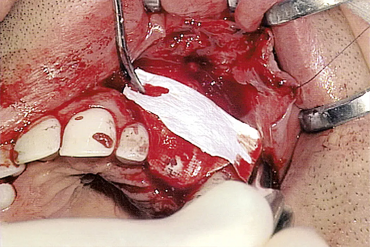 Colaxes (6)ejh