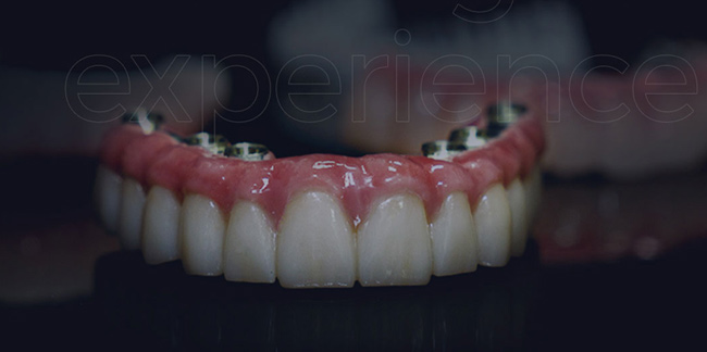 Digital Repair System detail (7)dj2