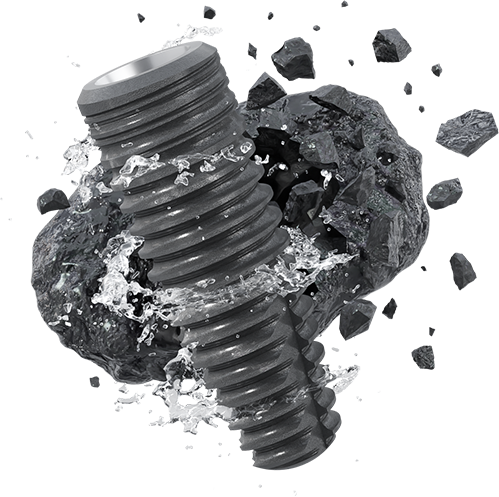 Excellence Series Implant System01q28