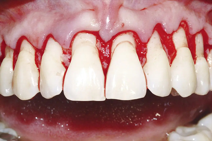 Periosteum img (6)0kr